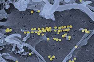 Crimean-Congo Hemorrhagic Fever Virus