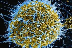 Ebola Zaire
