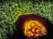 Measles Virus